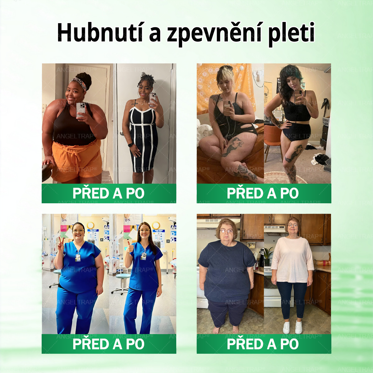 🚁🚁Oficiální prodejna  |  🧑‍⚕️ANGELTRAP® 𝐌𝐨𝐫𝐢𝐧𝐠𝐚 × 𝐁𝐞𝐫𝐛𝐞𝐫𝐲𝐧𝐚 × 𝐀𝐌𝐏𝐊 𝟏𝟎 v 1 – Zeštíhlující nano mikrojihlový náplast 🇨🇿 Jen 1× denně ✅ Viditelné změny za 7 dní – na obezitu, kardiovaskulární zdraví, diabetes a kloubní problémy