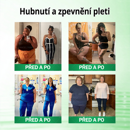 🚁🚁Oficiální prodejna  |  🧑‍⚕️ANGELTRAP® 𝐌𝐨𝐫𝐢𝐧𝐠𝐚 × 𝐁𝐞𝐫𝐛𝐞𝐫𝐲𝐧𝐚 × 𝐀𝐌𝐏𝐊 𝟏𝟎 v 1 – Zeštíhlující nano mikrojihlový náplast 🇨🇿 Jen 1× denně ✅ Viditelné změny za 7 dní – na obezitu, kardiovaskulární zdraví, diabetes a kloubní problémy